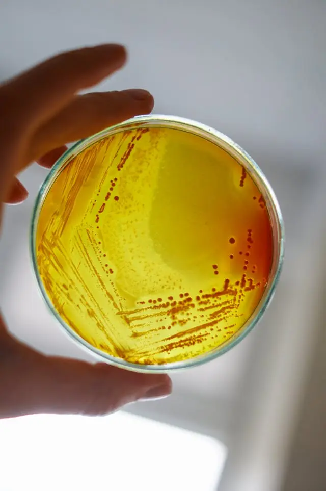 Piastra Petri con coltura gialla di Microrganismi Efficaci EM tenuta in mano, mostra crescita batterica probiotica